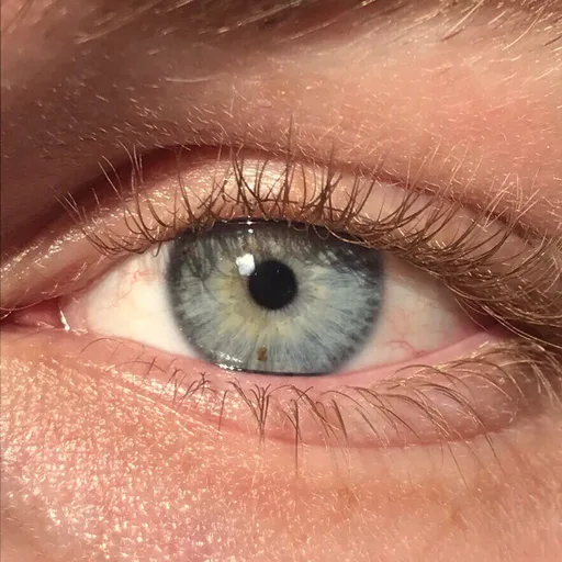 eye