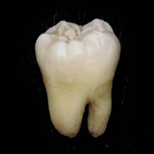 tooth